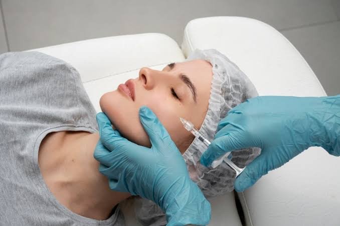Aplicaci&oacute;n de bioestimulador inyectable en el rostro