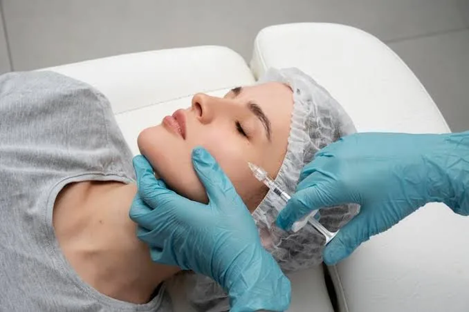 Aplicación de bioestimulador inyectable en el rostro