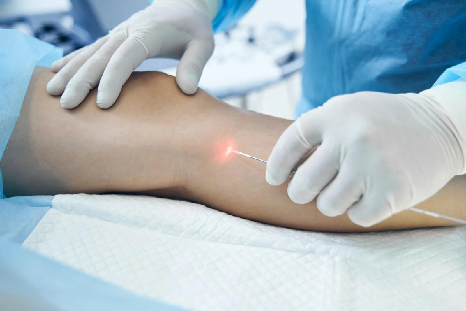 M.E.L.A Láser – lipólisis asistida por láser en Alma Estética