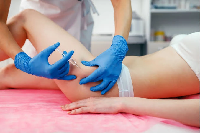 Sesión de Alidya: microinyecciones en la cara posterior del muslo