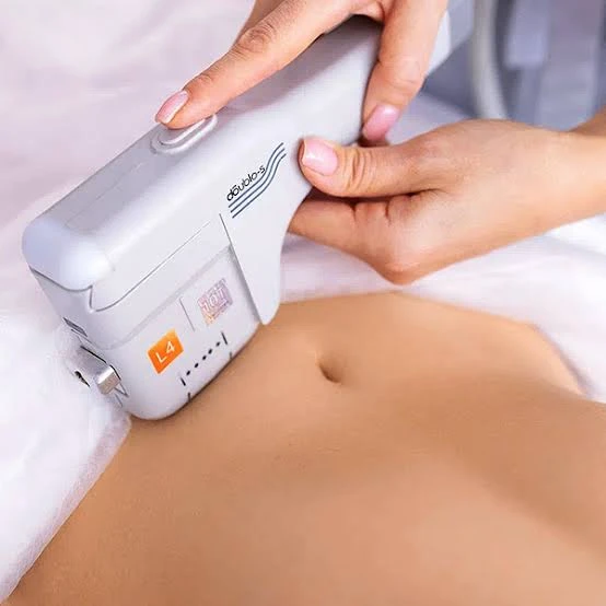 Aplicación de HIFU corporal sobre el abdomen con el cabezal del equipo