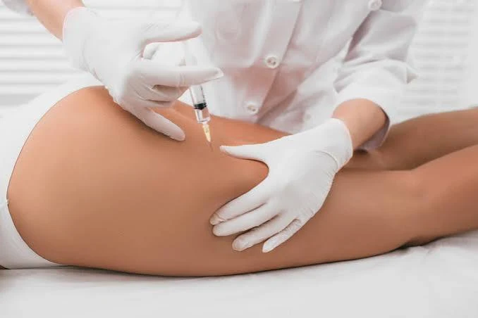 Aplicación de enzimas biológicas en la zona de glúteos y muslos, en consultorio