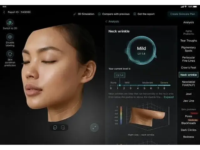Reporte digital del análisis de piel de Evelab con el mapa 3D del rostro y sus parámetros