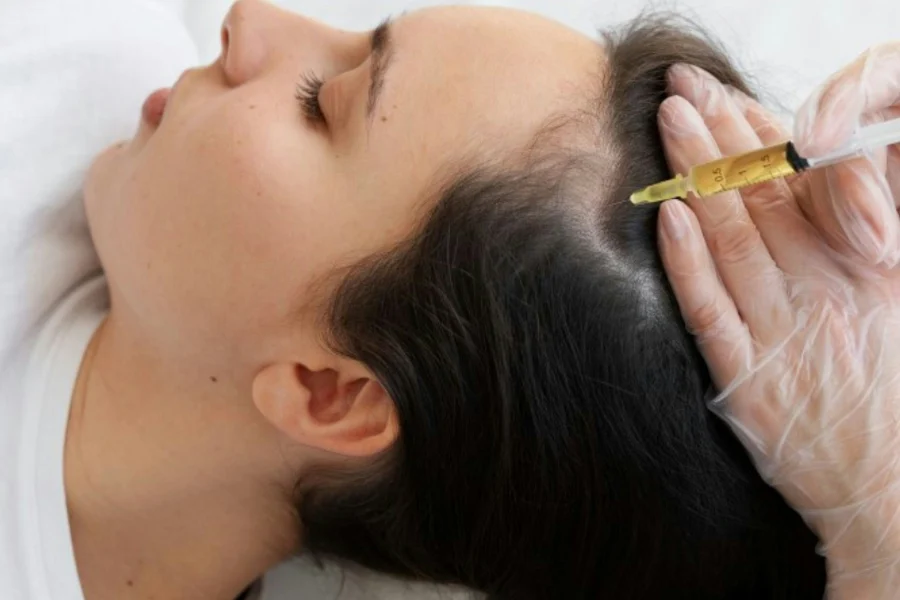 Aplicación de mesoterapia capilar con jeringa en el cuero cabelludo