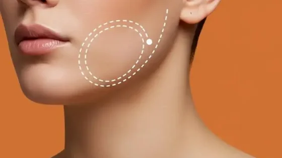 Papada sin cirugía: contorno mandibular marcado y cuello sin papada